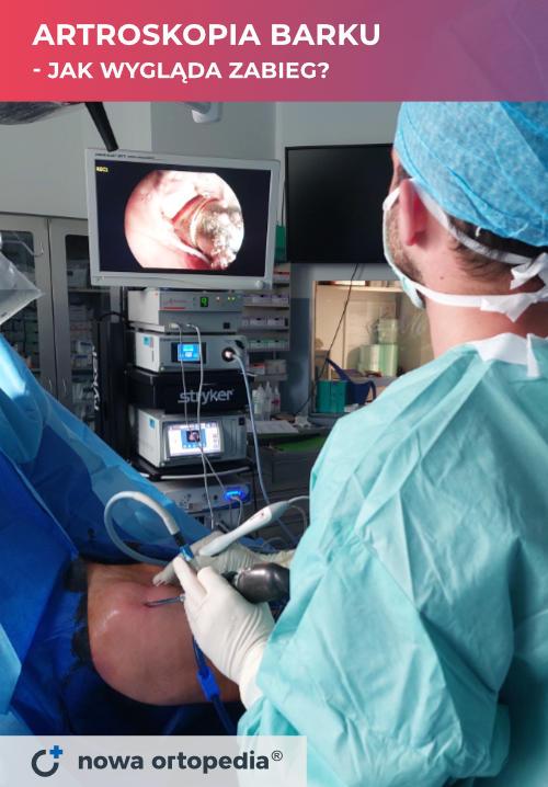 artroskopia barku - ortopeda przeprowadzający operację na sali operacyjnej