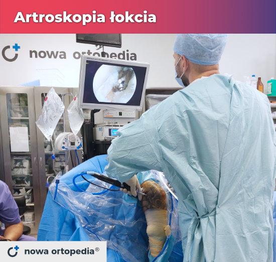 Artroskopia łokcia Kraków
