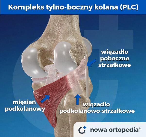 kompleks tylno boczny kolana PLC postero lateral corner