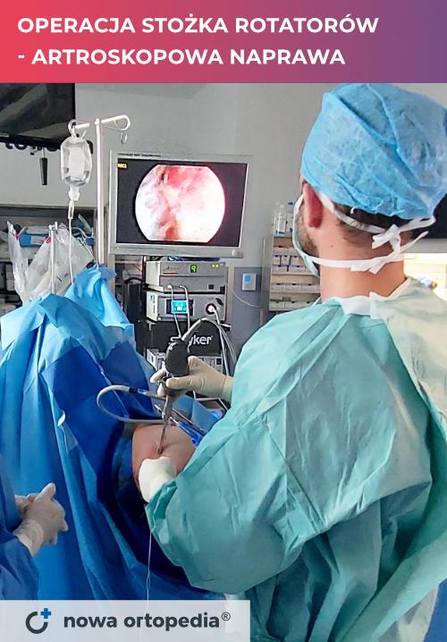 operacja stozka rotatorow - artroskopowa naprawa w wykonaniu ortopedy Huberta Laprusa