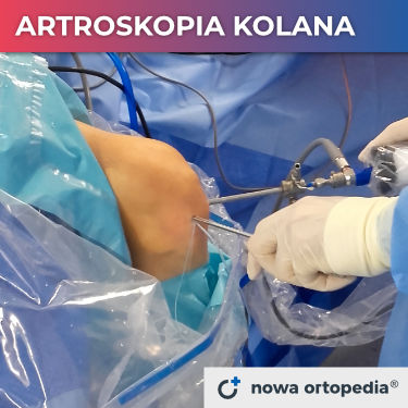 Artroskopia kolana Kraków